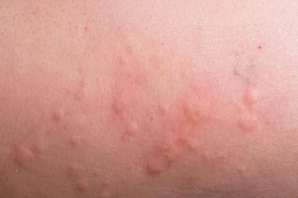 skin-hive-cluster.jpg