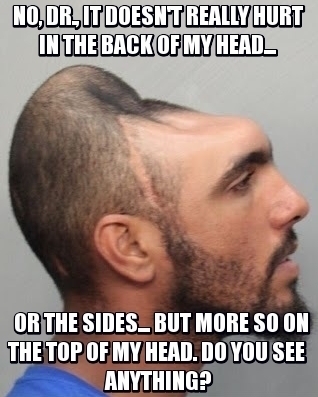 sLXFChD.jpg