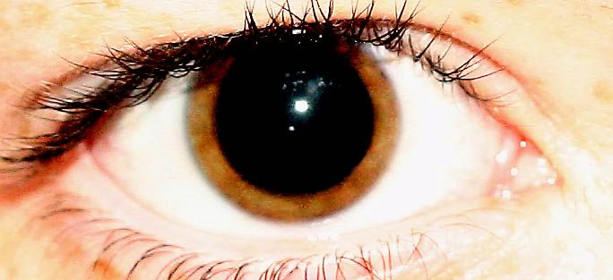 eye1.jpg