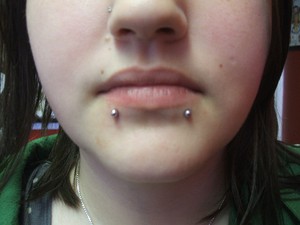snake_bites_1_001-sized_80023116.jpg