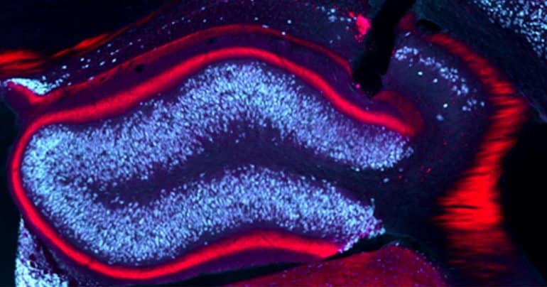 neurosciencenews.com