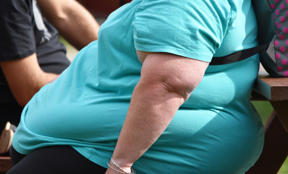 morbid-obesity.jpg