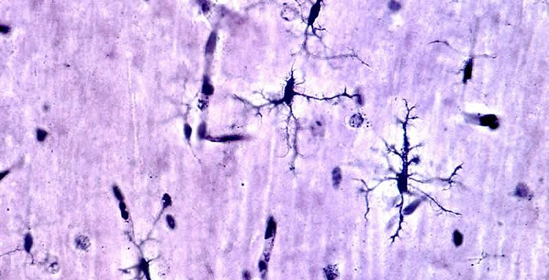 microglia-choline-alzhiemers-neuroscienenewxs.jpg